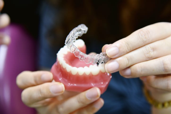 Kaip dantų tiesinimo kapos ištiesina dantis?