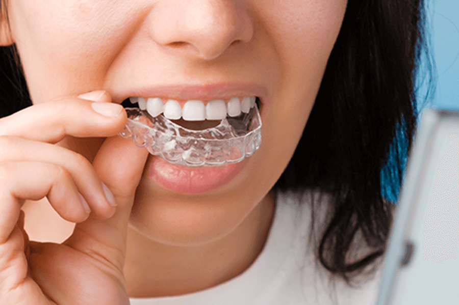 Kokie yra dantų tiesinimo kapomis trūkumai?