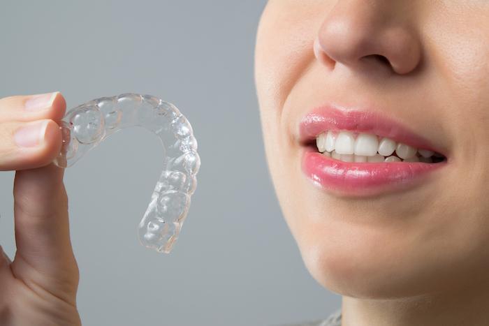 Ar galima dantų tiesinimo kapomis tiesinti TIK vieno žandikaulio dantis?